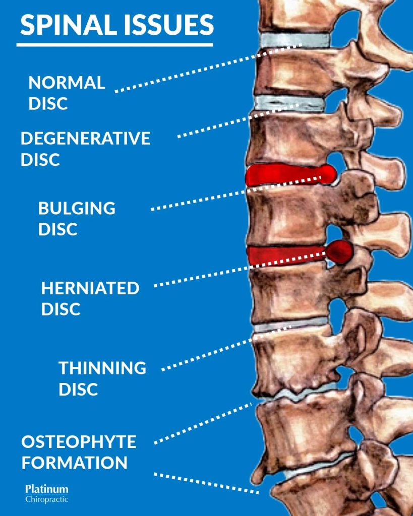 discs of a spine